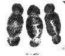 Cugnoles